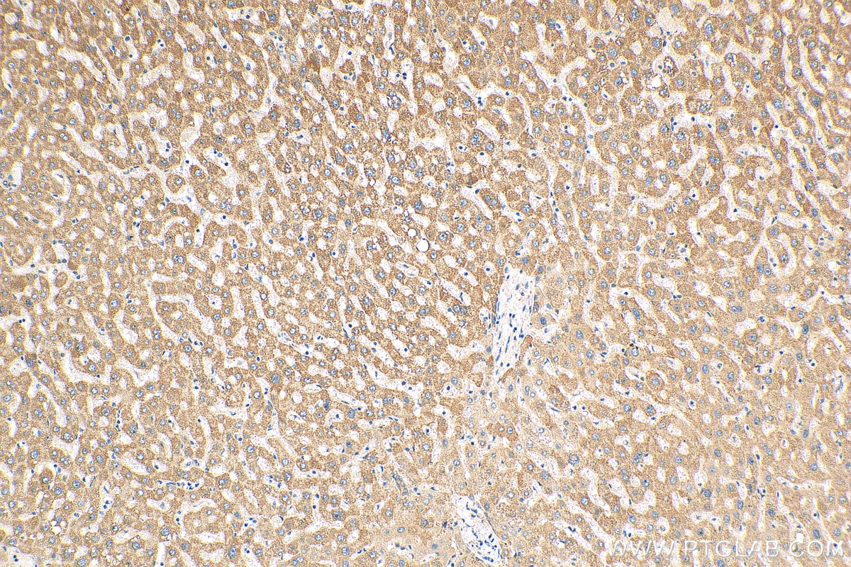 IHC staining of human liver using 17572-1-AP