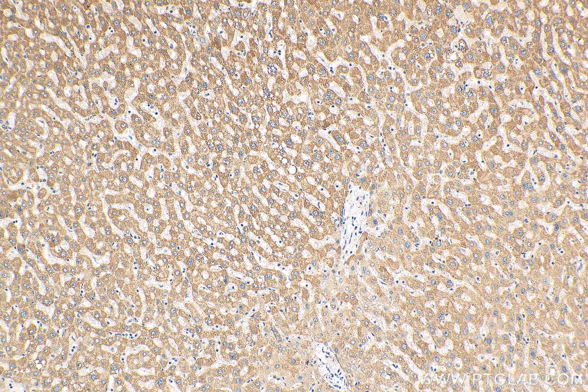 Immunohistochemistry (IHC) staining of human liver tissue using JNK Polyclonal antibody (17572-1-AP)