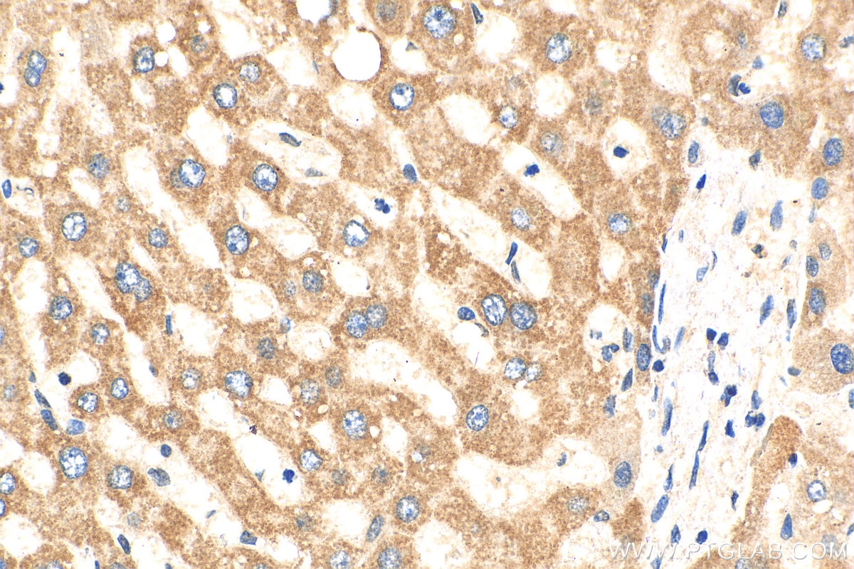 Immunohistochemistry (IHC) staining of human liver tissue using JNK Polyclonal antibody (17572-1-AP)