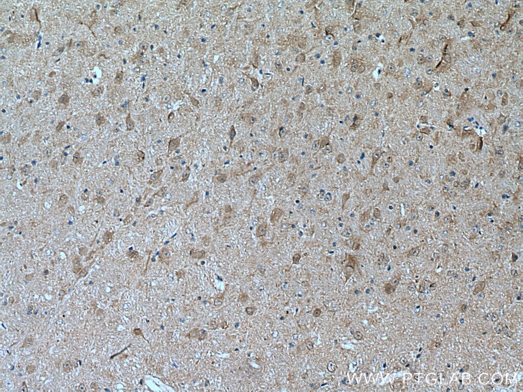 Immunohistochemistry (IHC) staining of mouse cerebellum tissue using JNK1/2/3 Polyclonal antibody (28007-1-AP)