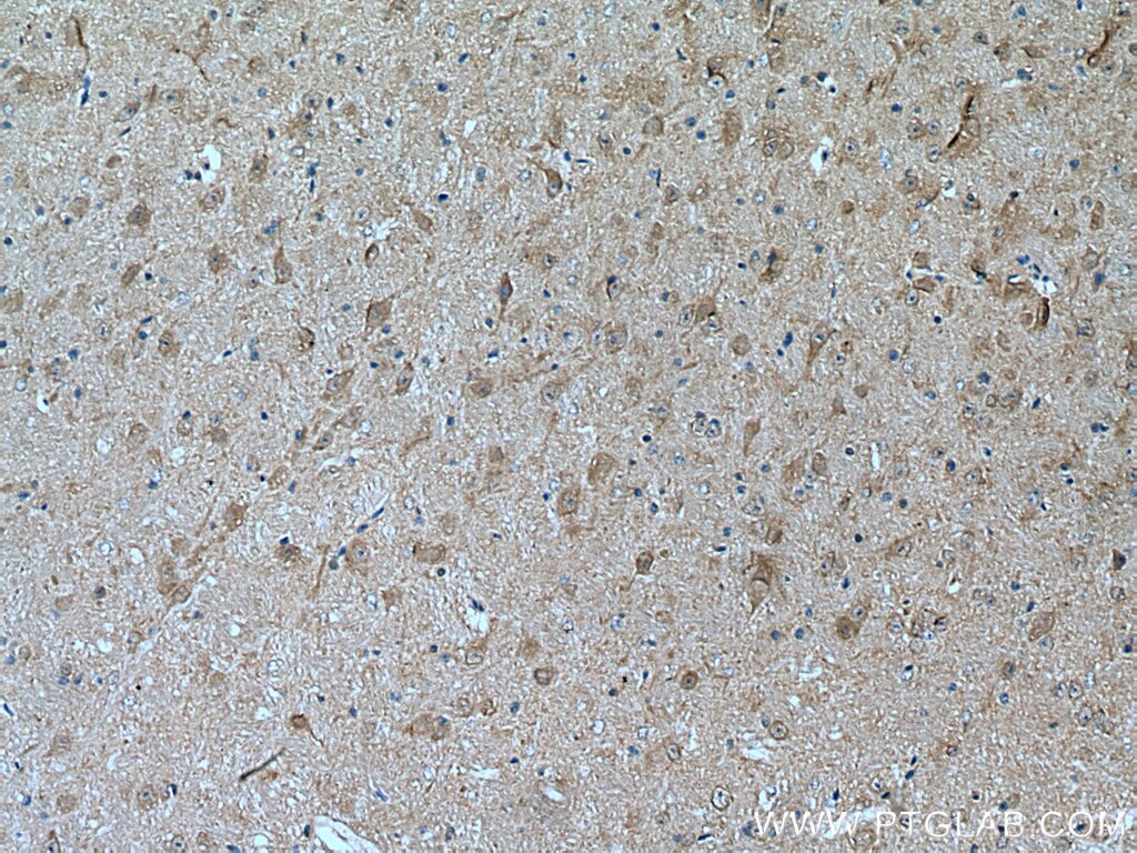 Immunohistochemistry (IHC) staining of mouse cerebellum tissue using JNK Polyclonal antibody (28007-1-AP)