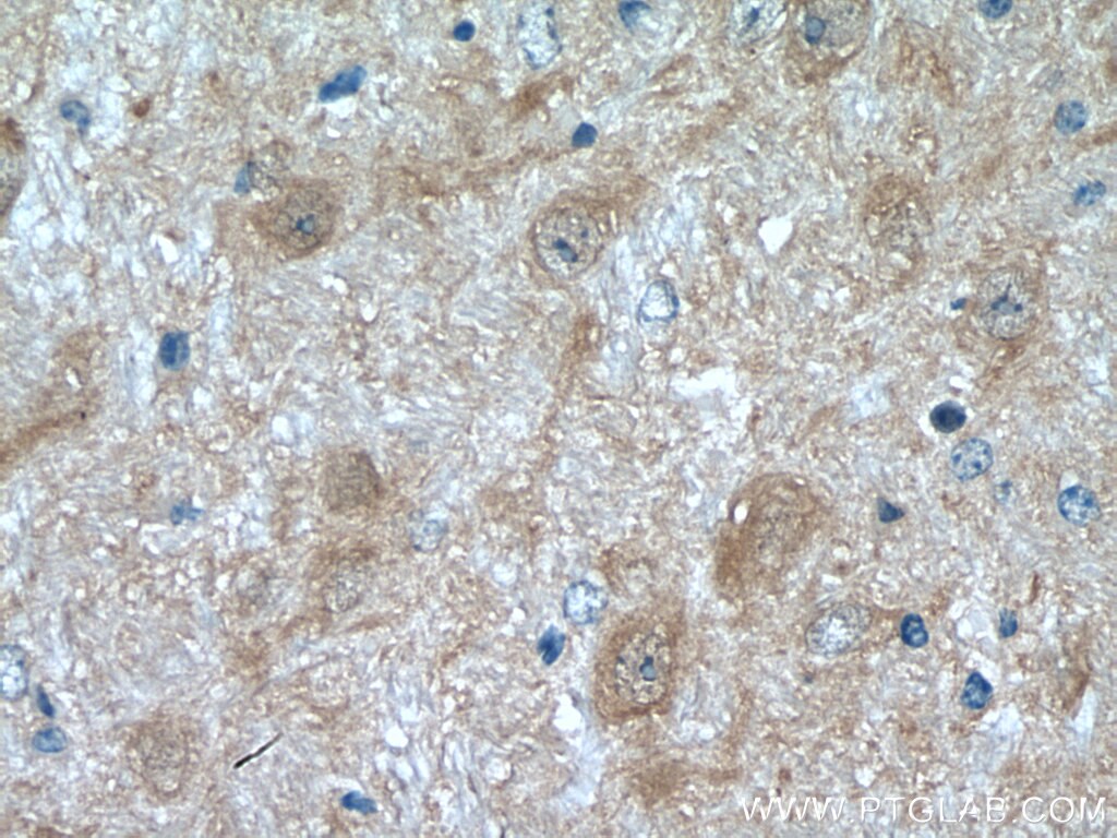 Immunohistochemistry (IHC) staining of mouse cerebellum tissue using JNK Polyclonal antibody (28007-1-AP)