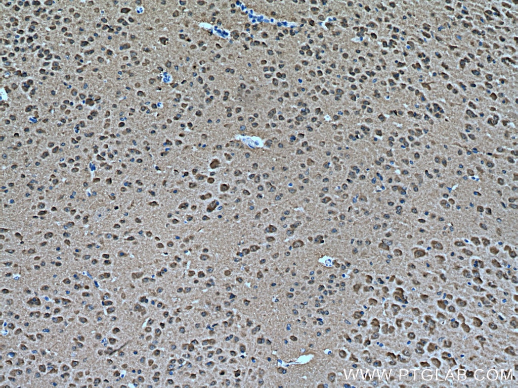 Immunohistochemistry (IHC) staining of mouse brain tissue using JNK1/2/3 Polyclonal antibody (28007-1-AP)