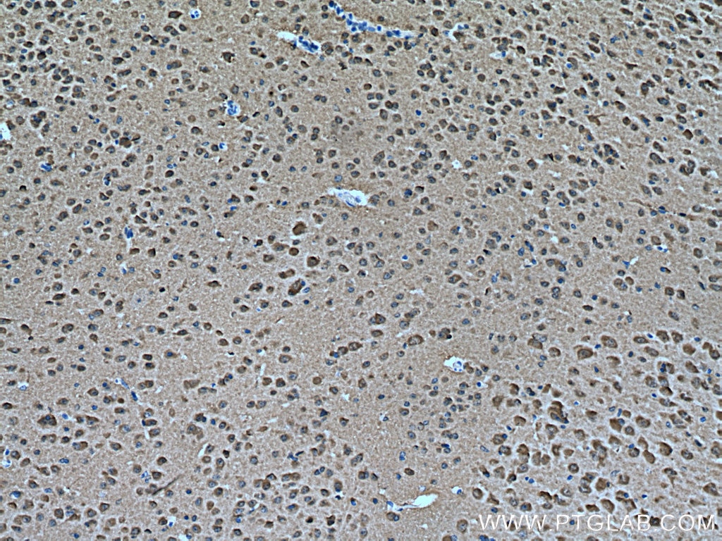 IHC staining of mouse brain using 28007-1-AP