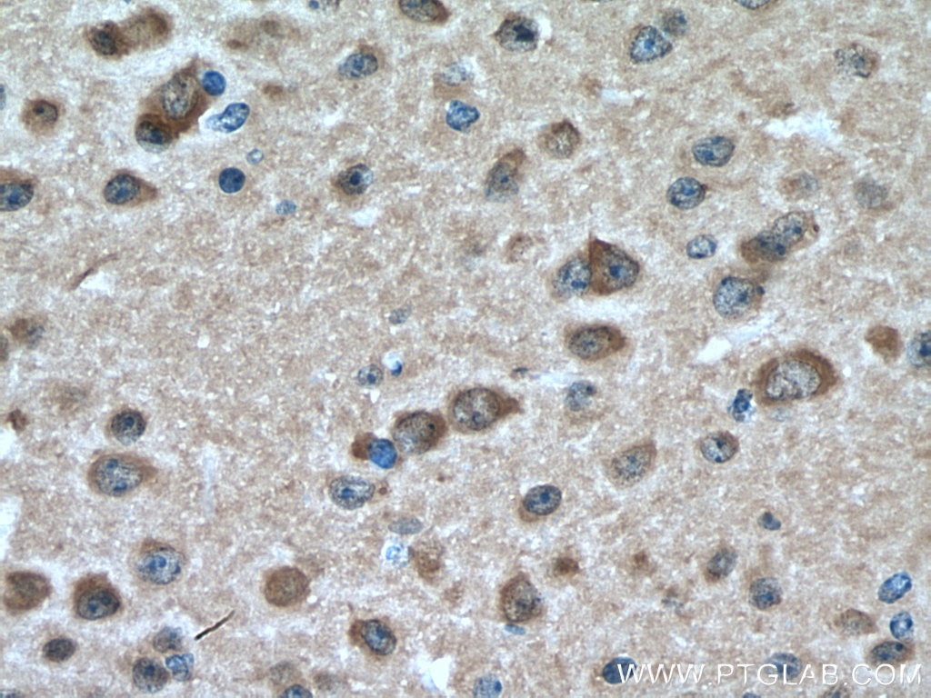 Immunohistochemistry (IHC) staining of mouse brain tissue using JNK Polyclonal antibody (28007-1-AP)