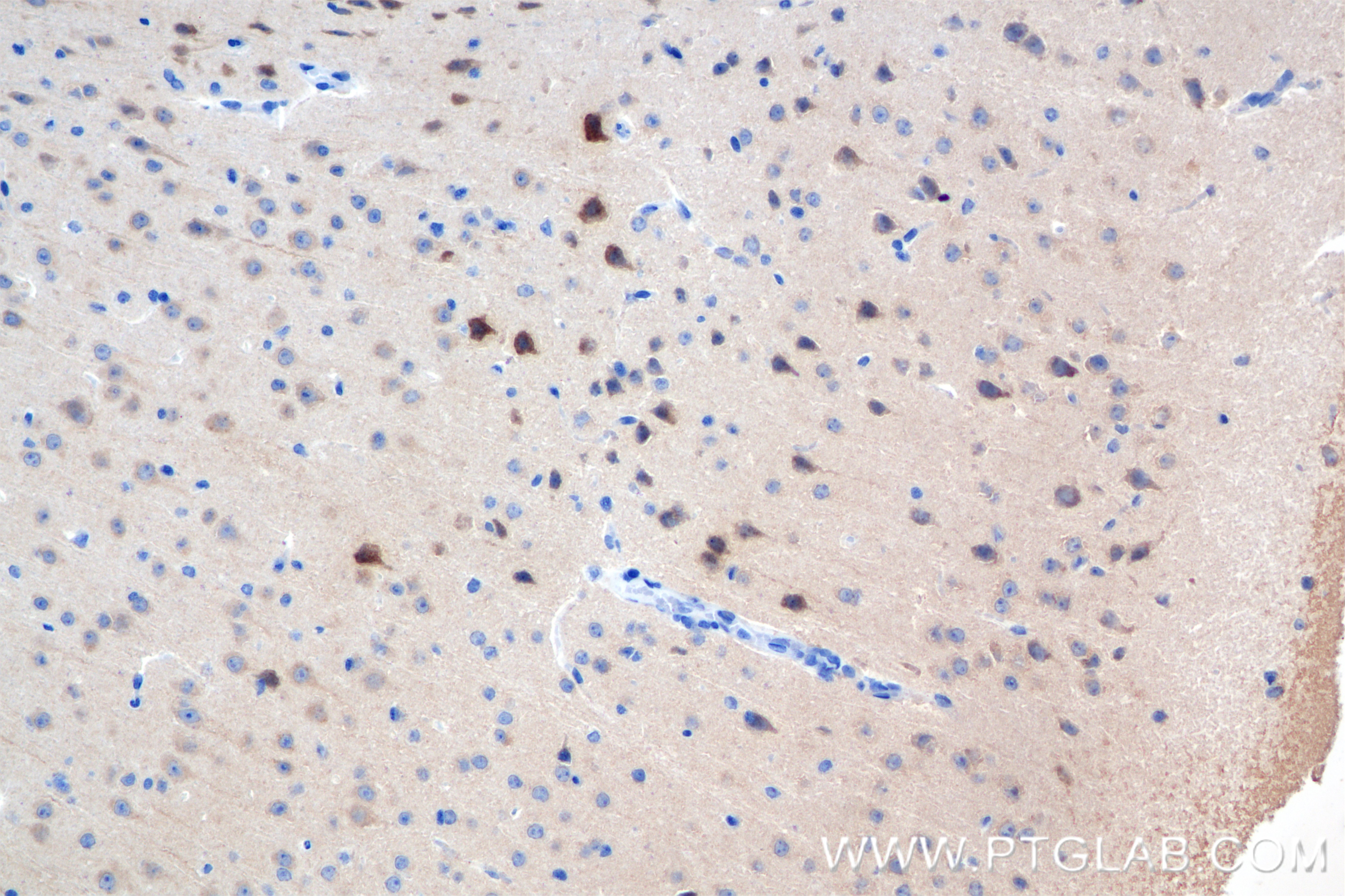 Immunohistochemistry (IHC) staining of mouse brain tissue using JNK Recombinant antibody (84875-5-RR)