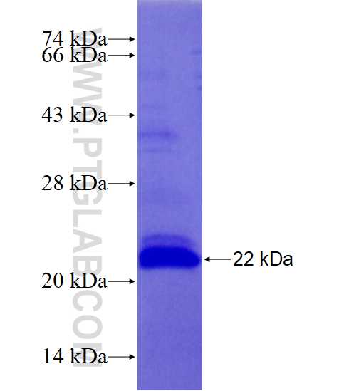 MAPK10 fusion protein Ag27840 SDS-PAGE
