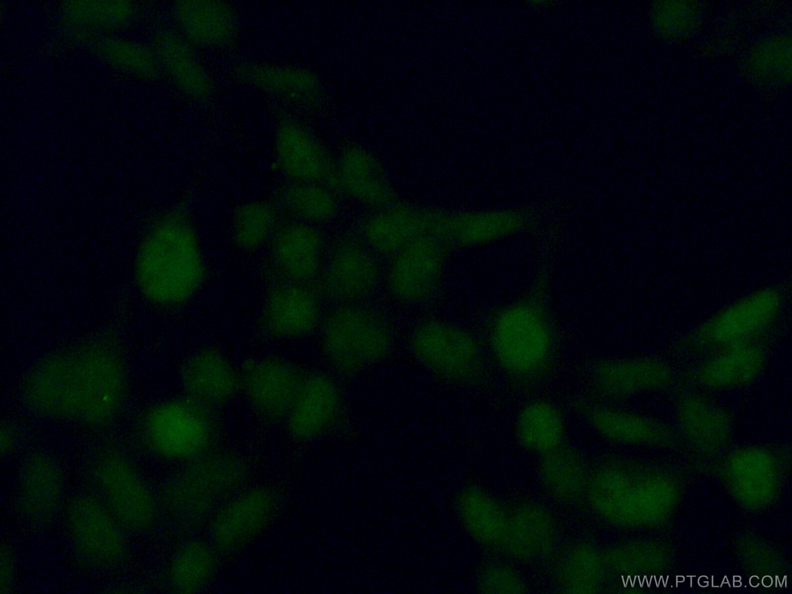 Immunofluorescence (IF) / fluorescent staining of HEK-293 cells using MAPK11 Polyclonal antibody (17376-1-AP)