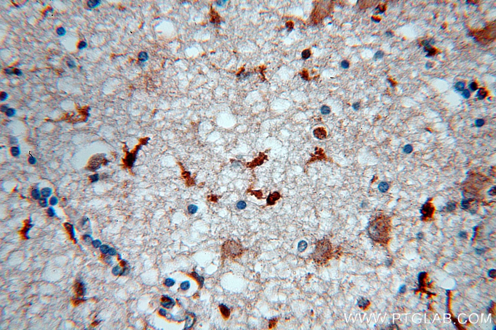 Immunohistochemistry (IHC) staining of human brain tissue using MAPK11 Polyclonal antibody (17376-1-AP)