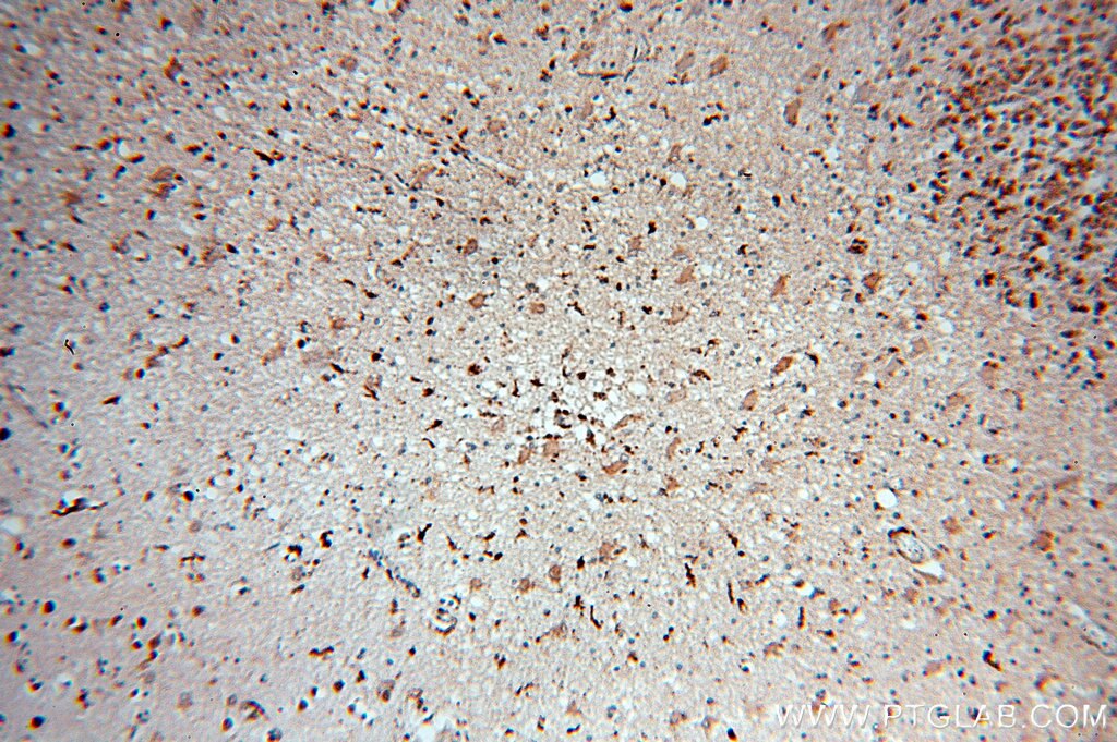 Immunohistochemistry (IHC) staining of human brain tissue using MAPK11 Polyclonal antibody (17376-1-AP)