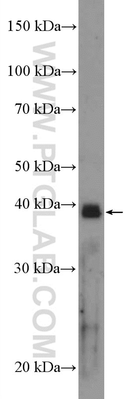 Western Blot (WB) analysis of mouse skeletal muscle tissue using MAPK11 Polyclonal antibody (17376-1-AP)