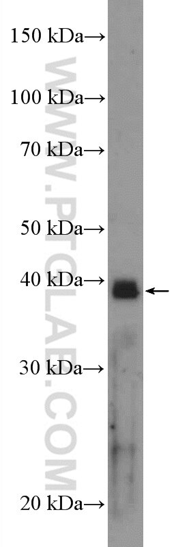 WB analysis of mouse skeletal muscle using 17376-1-AP