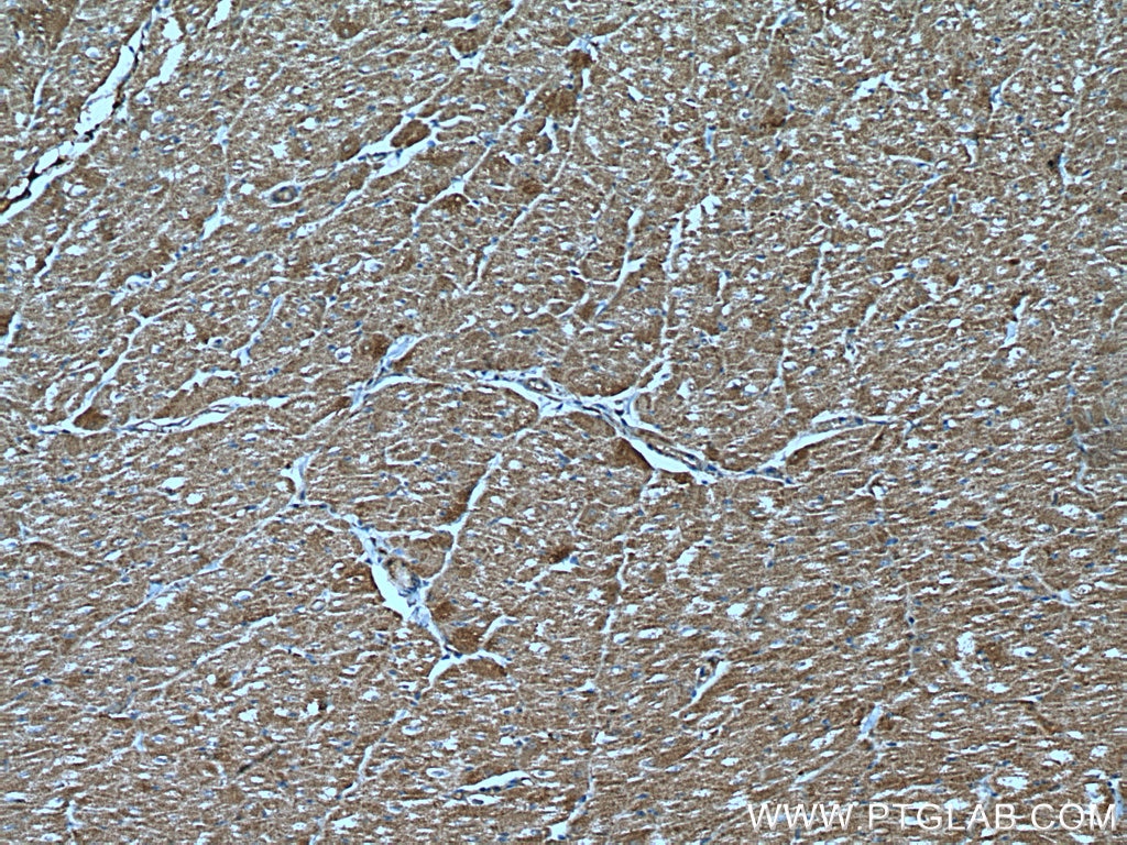 IHC staining of human heart using 20184-1-AP