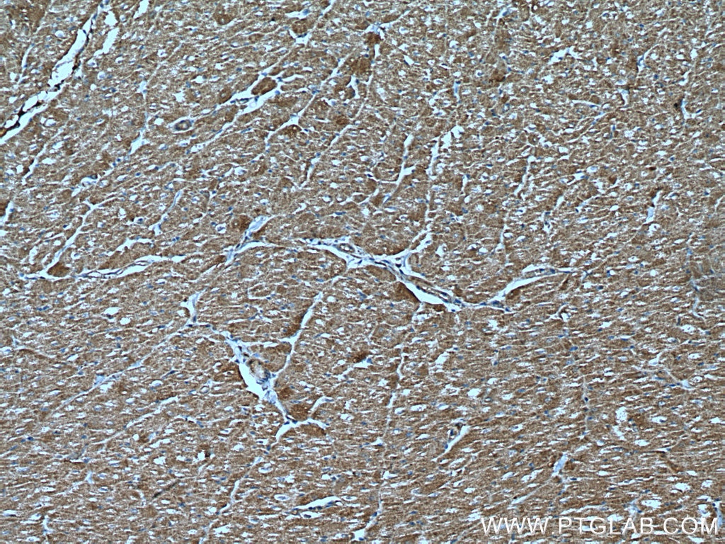 Immunohistochemistry (IHC) staining of human heart tissue using MAPK12 Polyclonal antibody (20184-1-AP)