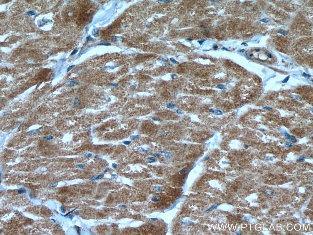 Immunohistochemistry (IHC) staining of human heart tissue using MAPK12 Polyclonal antibody (20184-1-AP)