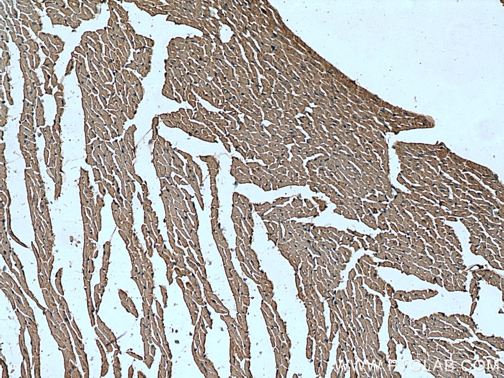 Immunohistochemistry (IHC) staining of mouse heart tissue using MAPK12 Polyclonal antibody (20184-1-AP)