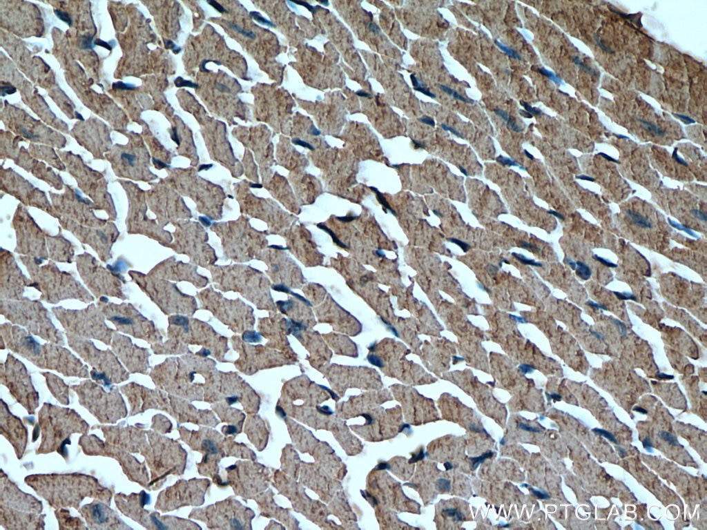 Immunohistochemistry (IHC) staining of mouse heart tissue using MAPK12 Polyclonal antibody (20184-1-AP)