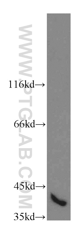 Western Blot (WB) analysis of mouse skeletal muscle tissue using MAPK12 Polyclonal antibody (20184-1-AP)