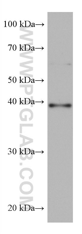 Western Blot (WB) analysis of Daudi cells using MAPK13 Monoclonal antibody (60252-1-Ig)