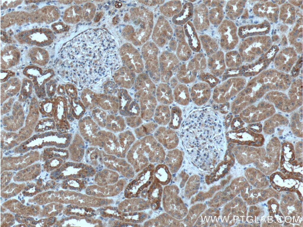 Immunohistochemistry (IHC) staining of human kidney tissue using MAPK15 Polyclonal antibody (13452-1-AP)