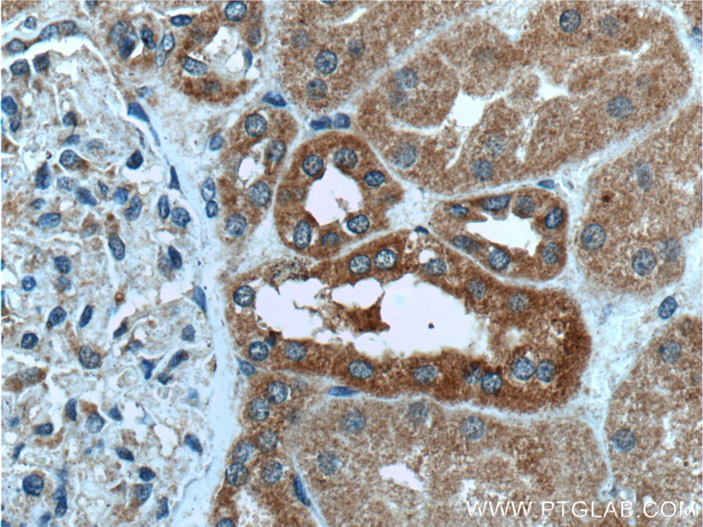 Immunohistochemistry (IHC) staining of human kidney tissue using MAPK15 Polyclonal antibody (13452-1-AP)