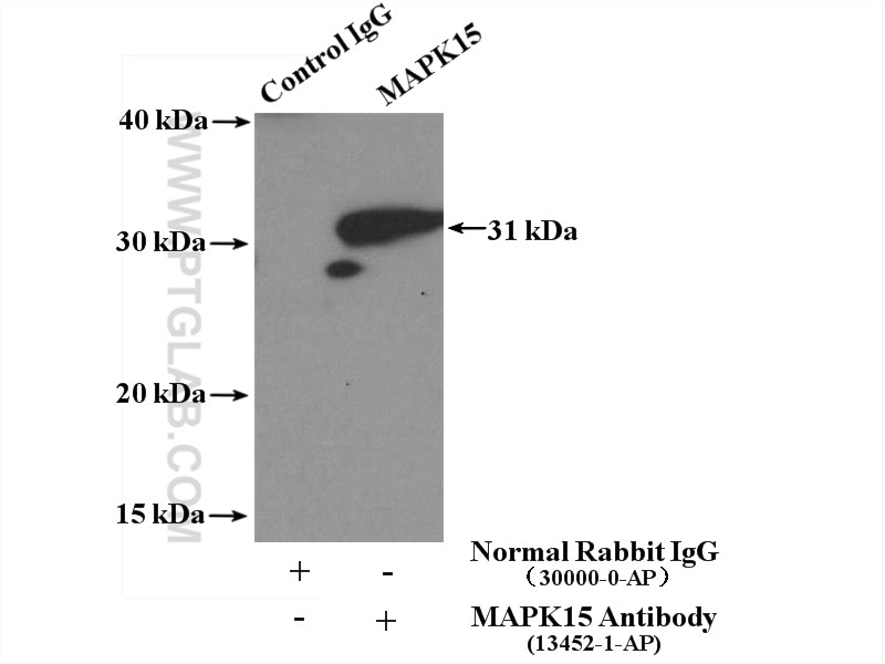Immunoprecipitation (IP) experiment of mouse lung tissue using MAPK15 Polyclonal antibody (13452-1-AP)