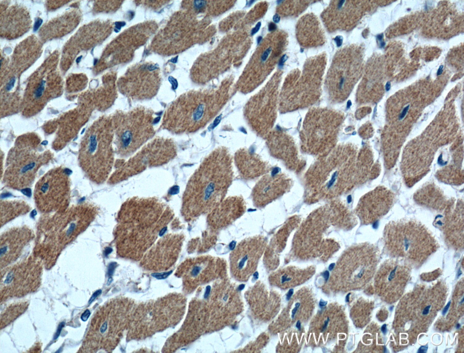 Immunohistochemistry (IHC) staining of human heart tissue using MAPK4 Polyclonal antibody (18738-1-AP)