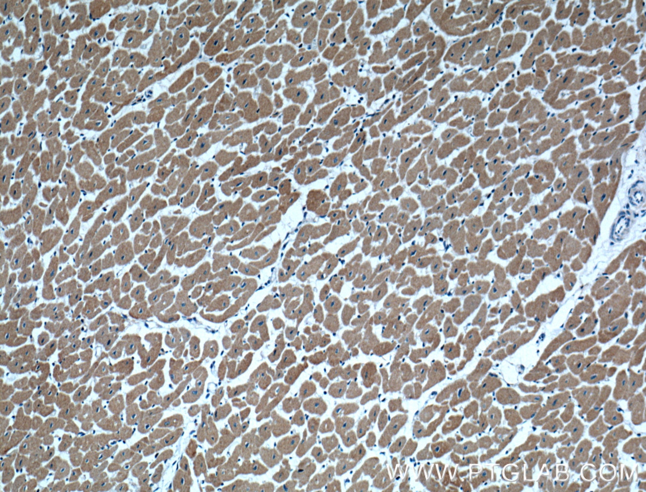 Immunohistochemistry (IHC) staining of human heart tissue using MAPK4 Polyclonal antibody (18738-1-AP)