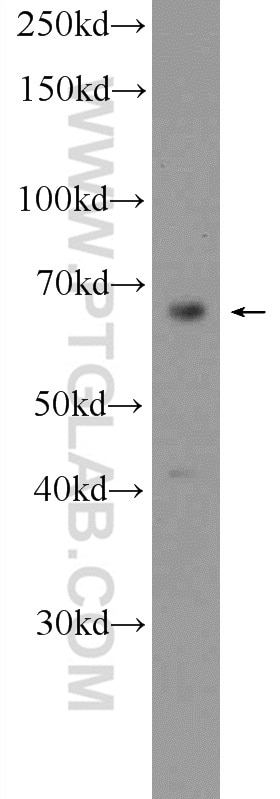 Western Blot (WB) analysis of mouse brain tissue using MAPK4 Polyclonal antibody (18738-1-AP)