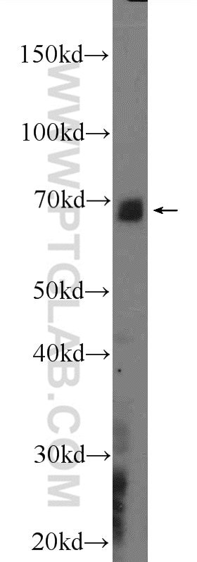 Western Blot (WB) analysis of rat brain tissue using MAPK4 Polyclonal antibody (18738-1-AP)