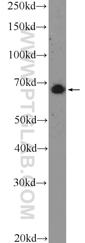 Western Blot (WB) analysis of mouse brain tissue using MAPK4 Polyclonal antibody (26102-1-AP)