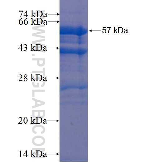 MAPK4 fusion protein Ag22899 SDS-PAGE