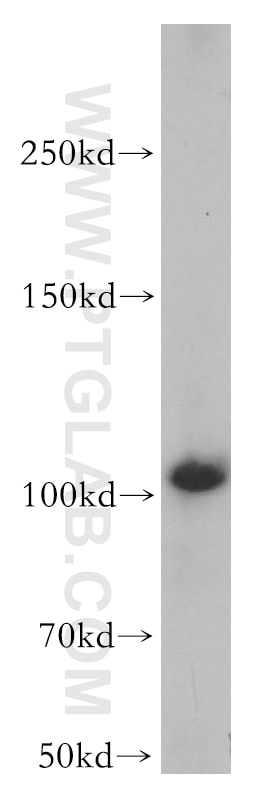 Western Blot (WB) analysis of A431 cells using MAPK6 Polyclonal antibody (12839-1-AP)
