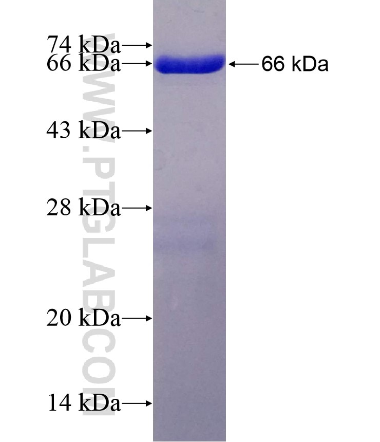 MAPK6 fusion protein Ag3577 SDS-PAGE
