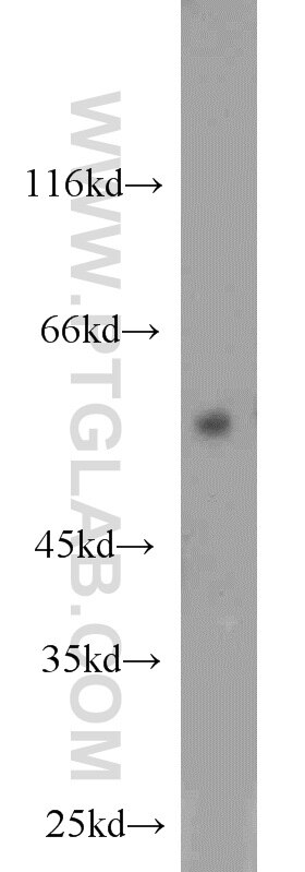 ERK5