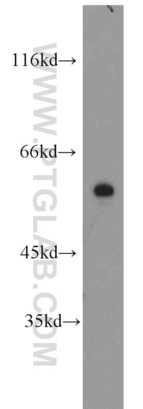 Western Blot (WB) analysis of human heart tissue using ERK5 Polyclonal antibody (10036-2-AP)
