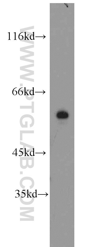 Western Blot (WB) analysis of human heart tissue using MAPK7 Polyclonal antibody (10036-2-AP)