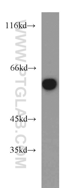 Western Blot (WB) analysis of mouse skeletal muscle tissue using MAPK7 Polyclonal antibody (10036-2-AP)