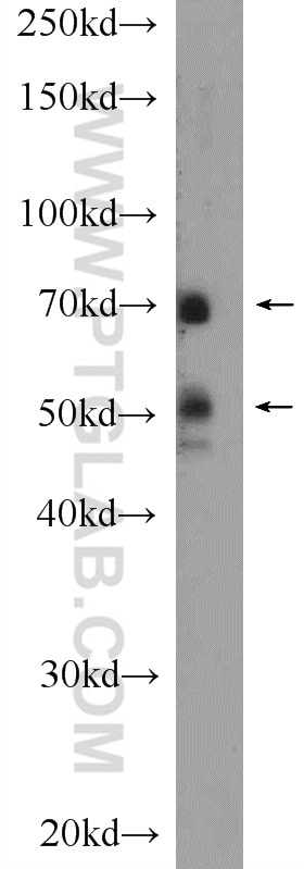 Western Blot (WB) analysis of mouse heart tissue using MAPK7 Polyclonal antibody (11164-1-AP)