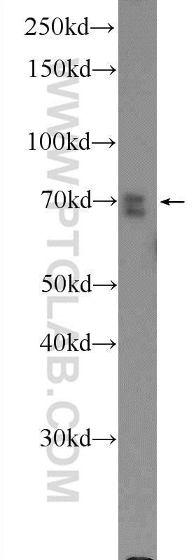 Western Blot (WB) analysis of HEK-293 cells using MAPK7 Polyclonal antibody (11164-1-AP)
