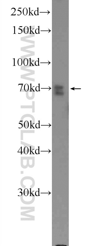 Western Blot (WB) analysis of HEK-293 cells using ERK5 Polyclonal antibody (11164-1-AP)