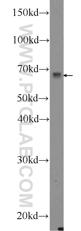Western Blot (WB) analysis of mouse testis tissue using ERK5 Polyclonal antibody (11164-1-AP)