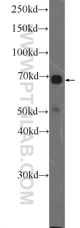 Western Blot (WB) analysis of SKOV-3 cells using ERK5 Polyclonal antibody (11164-1-AP)