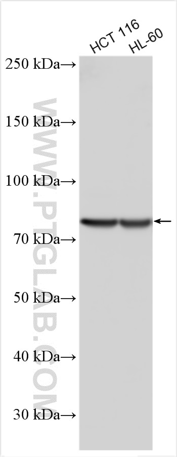 Various lysates were subjected to SDS PAGE followed by western blot with 11164-1-AP (MAPK7 antibody) at dilution of 1:500 incubated at room temperature for 1.5 hours. Western Blot (WB) analysis of various lysates using ERK5 Polyclonal antibody (11164-1-AP)