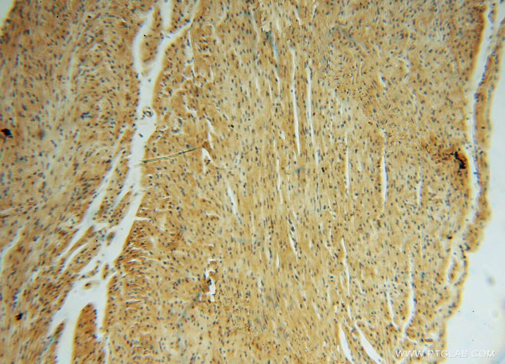 IHC staining of human heart using 13912-1-AP