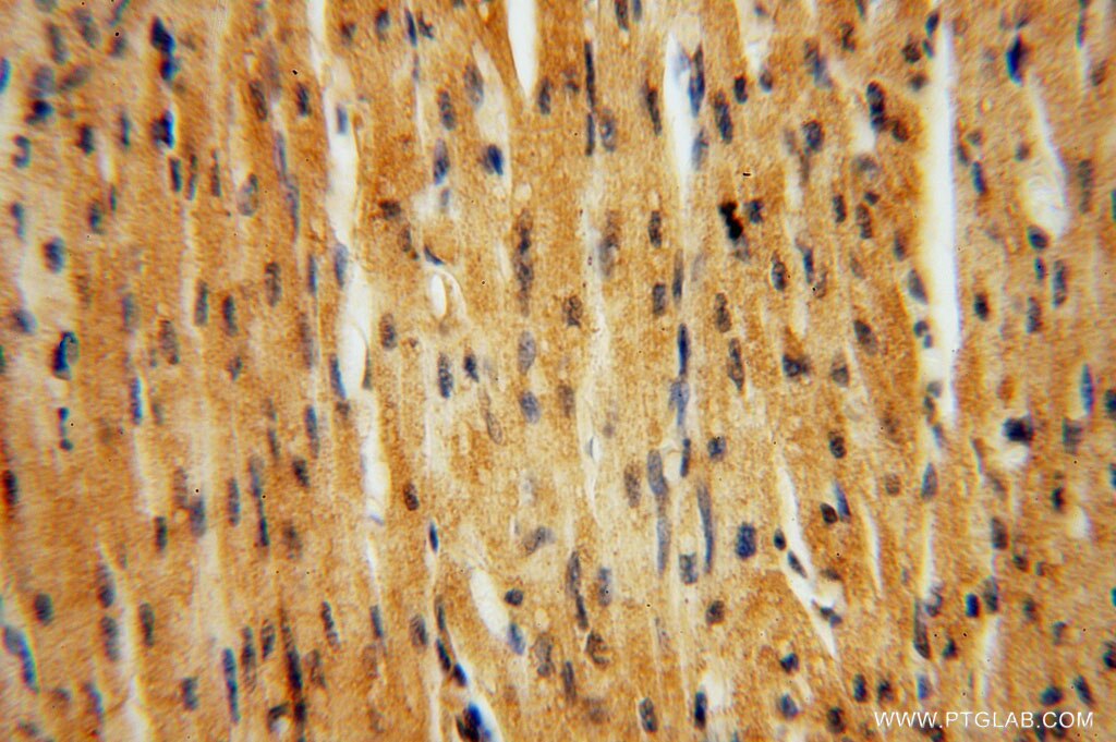 Immunohistochemistry (IHC) staining of human heart tissue using JIP2 Polyclonal antibody (13912-1-AP)