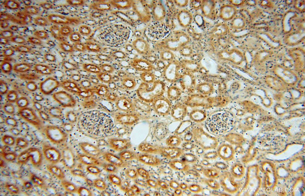 Immunohistochemistry (IHC) staining of human kidney tissue using JIP2 Polyclonal antibody (13912-1-AP)