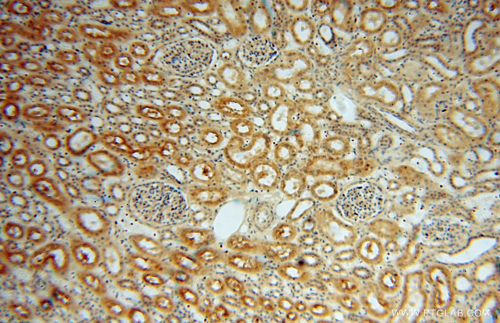 IHC staining of human kidney using 13912-1-AP