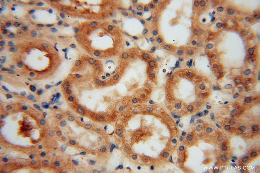 IHC staining of human kidney using 13912-1-AP