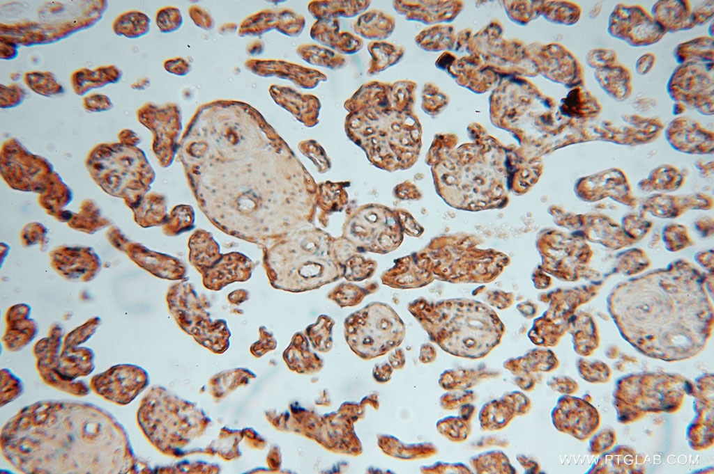 IHC staining of human placenta using 13912-1-AP